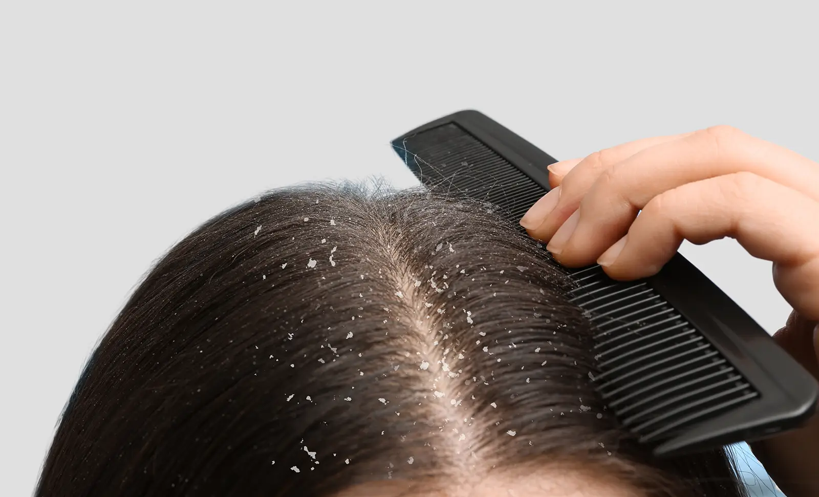 Como identificar o Scab Hair em casa