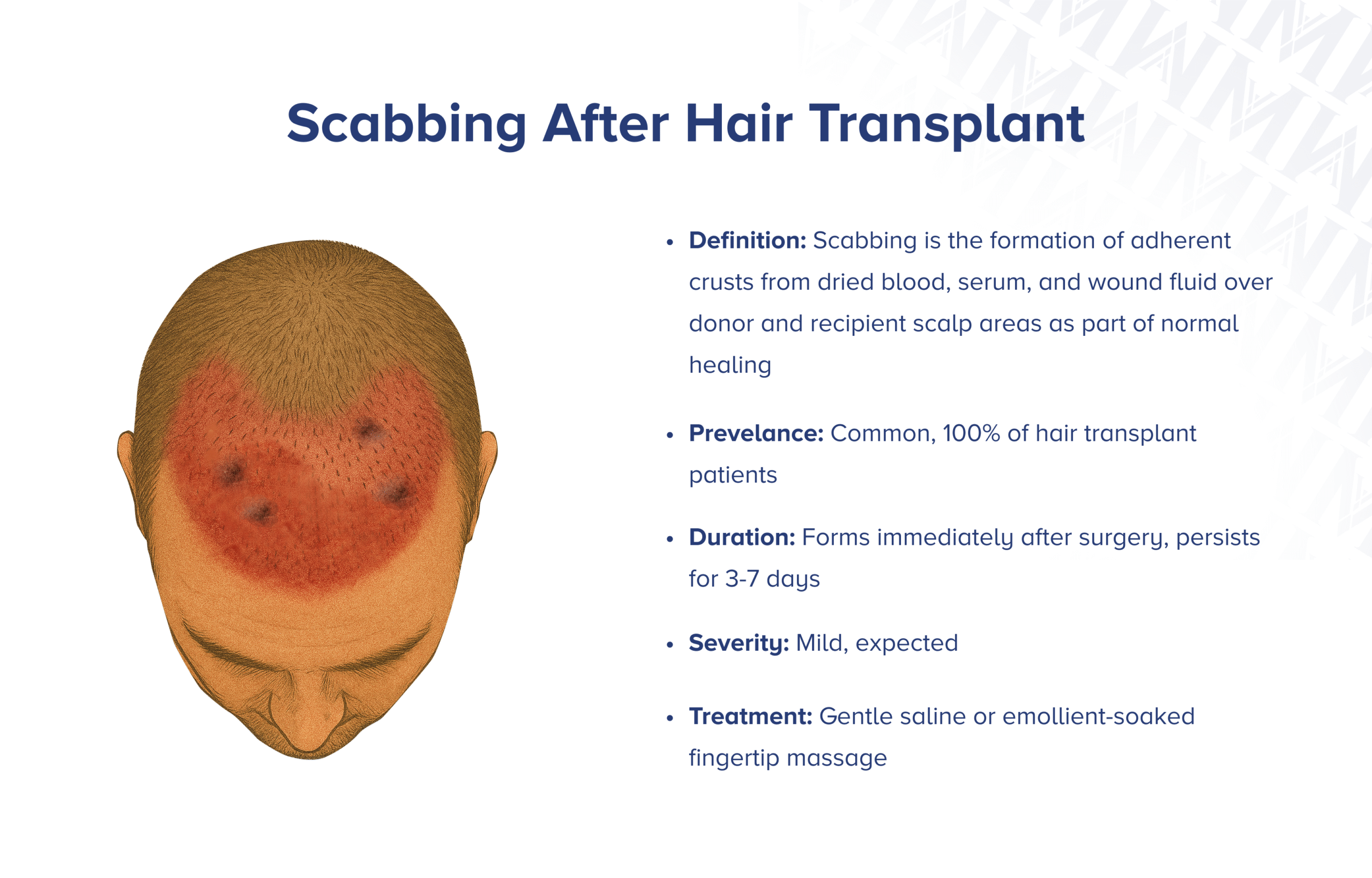 Os melhores óleos vegetais para tratar Scab Hair
