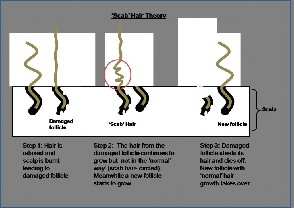 Os melhores óleos vegetais para tratar Scab Hair