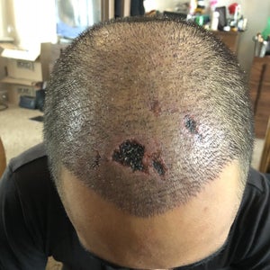 Guia completo de Cronograma Capilar para cabelos com Scab Hair