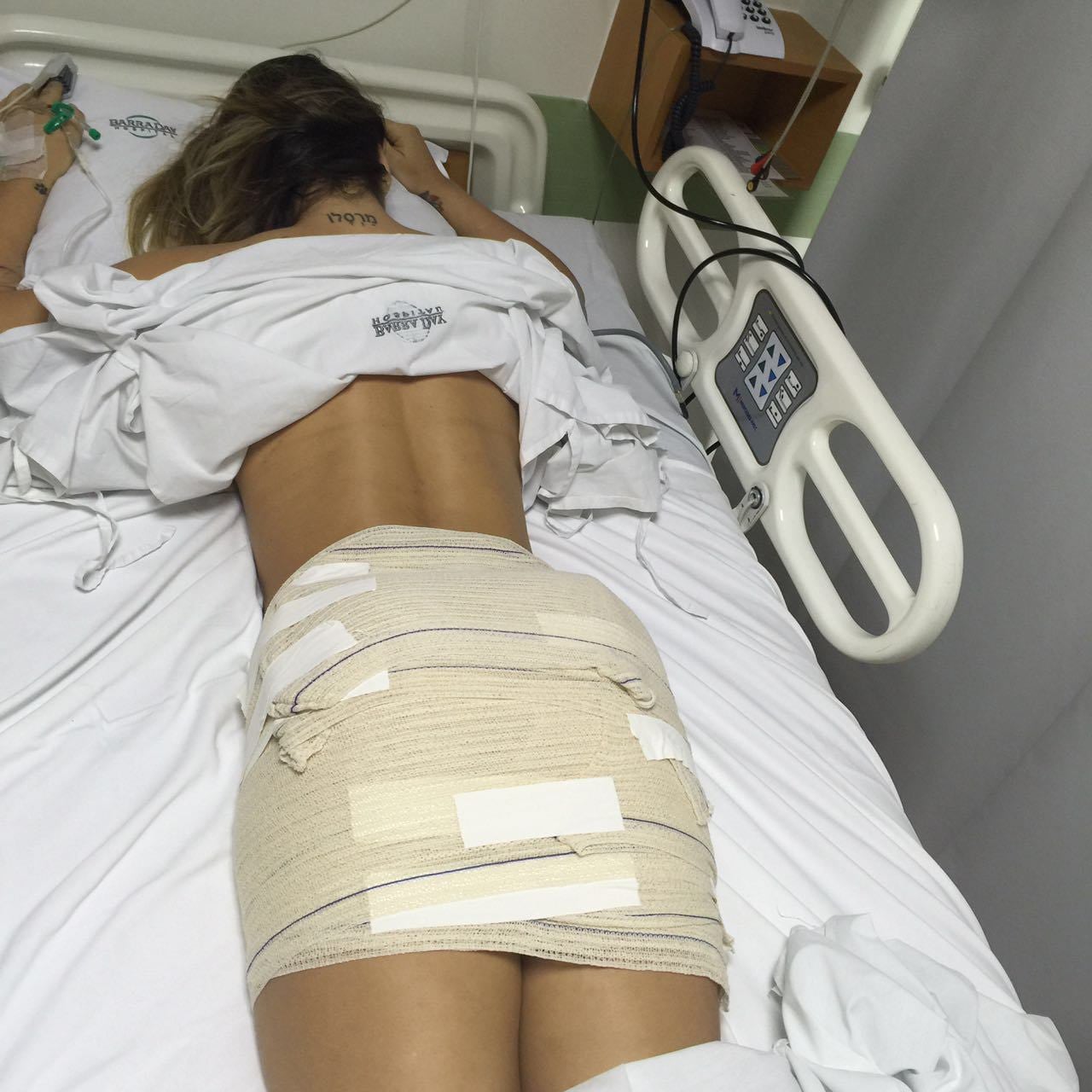 Silicone Industrial vs. Prótese de Glúteo: Entenda os Riscos e Diferenças Cruciais