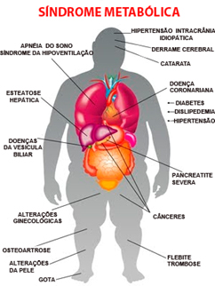 O Papel do Endocrinologista no Tratamento da Síndrome Metabólica