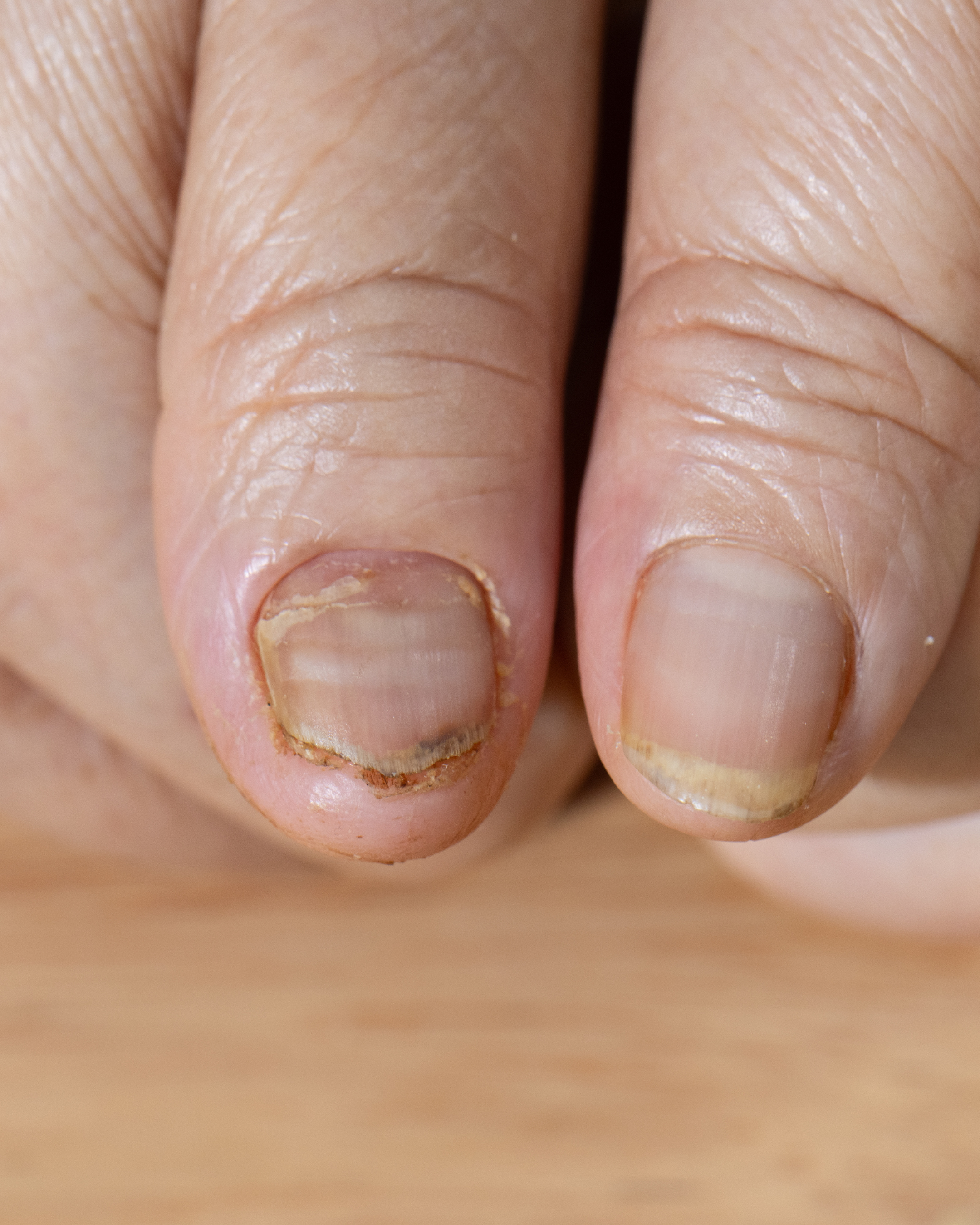 Tendências de Nail Art com Listras para 2025 e 2026