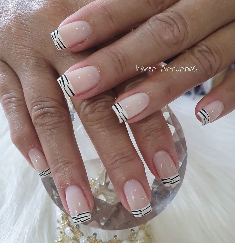 O Que as Listras Naturais nas Suas Unhas Podem Indicar Sobre Sua Saúde