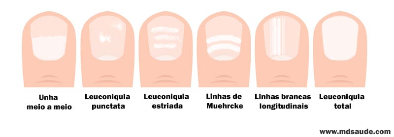 Tendências de Nail Art com Listras para 2025 e 2026