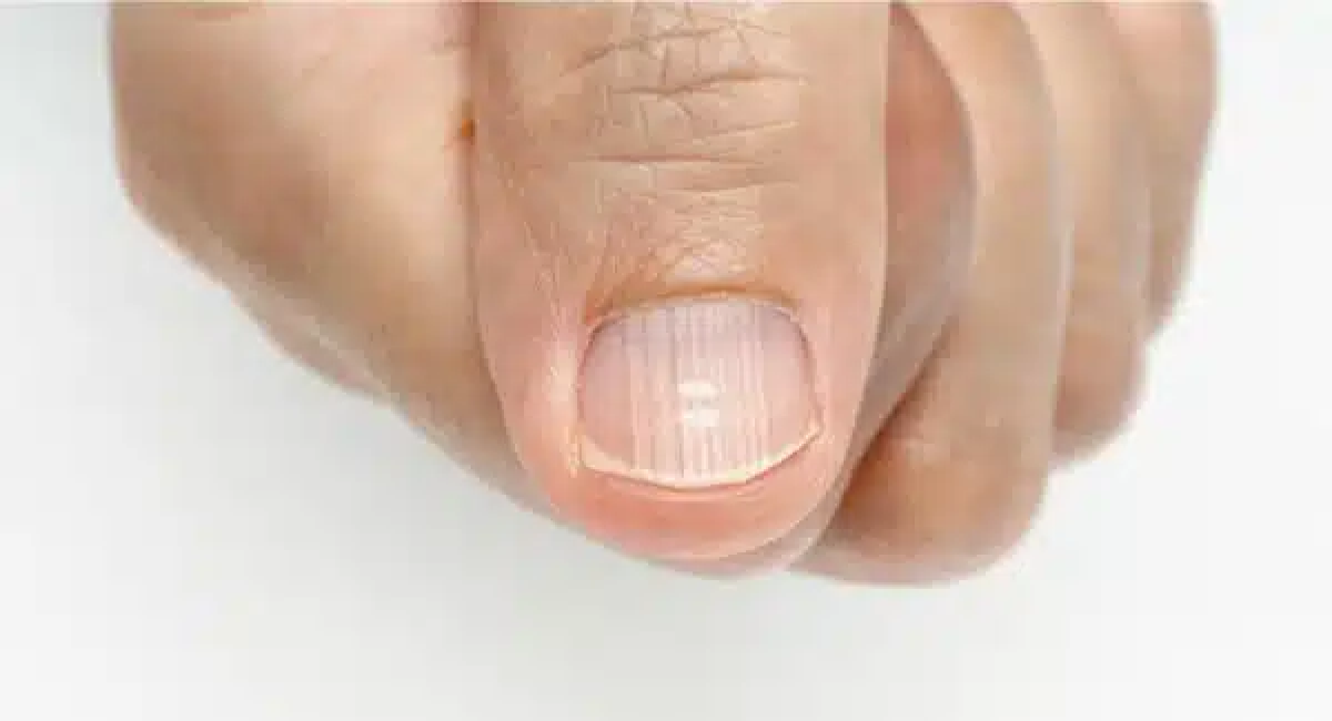 Guia Completo: Como Fazer Unhas Listradas Perfeitas em Casa